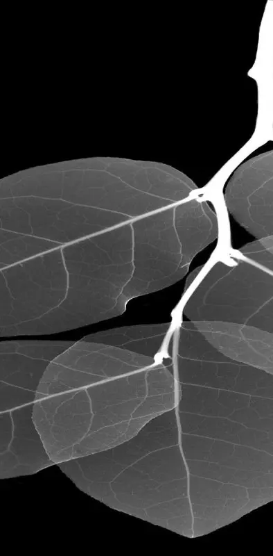 X-ray Leaves