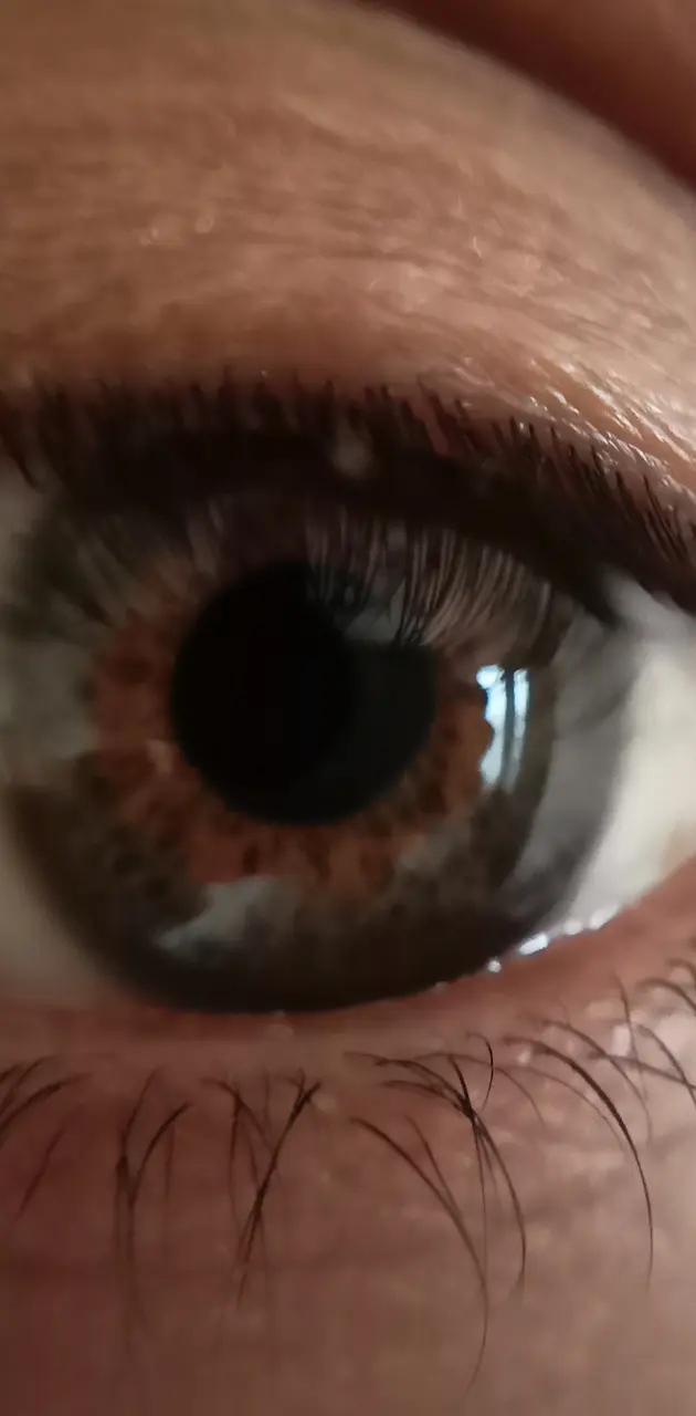 Eye