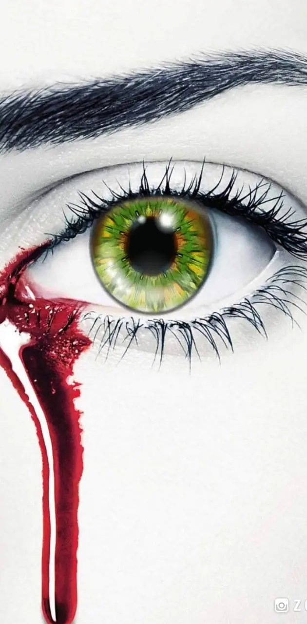 Bleeding eye